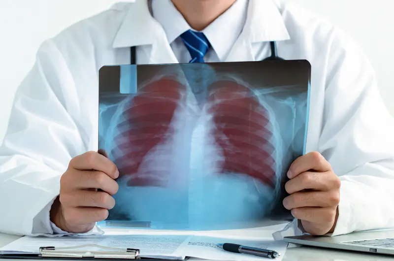 How Do You Code Chronic Lung Disease?