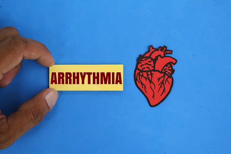 How A Cardiology Medical Billing Company Codes Heart Arrhythmias