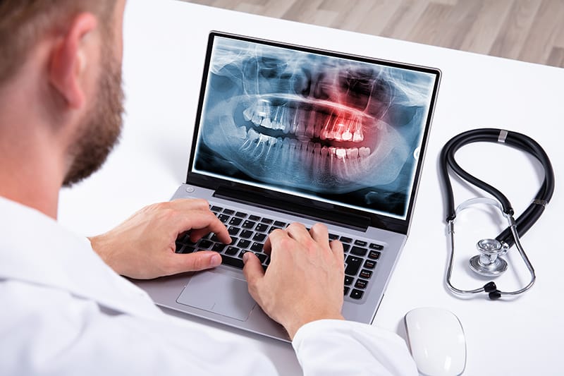 Medical Coding For Alveoloplasty With Extractions For A Dental Billing Company
