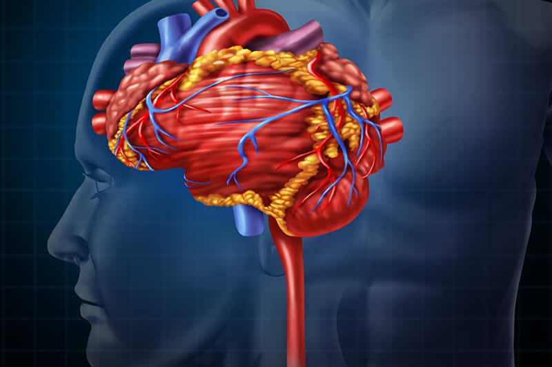 Medical Coding of Stroke and Stroke Risk Factors