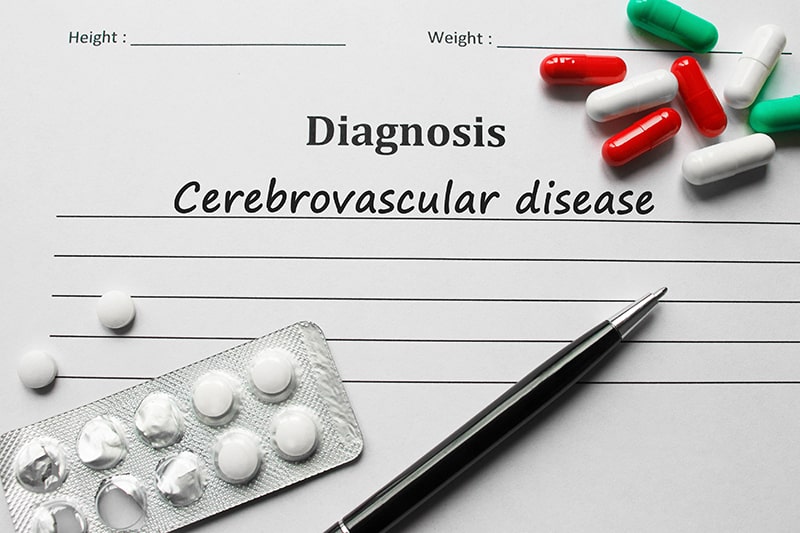 Top Five Cerebrovascular Diseases and Their Related ICD-10 codes