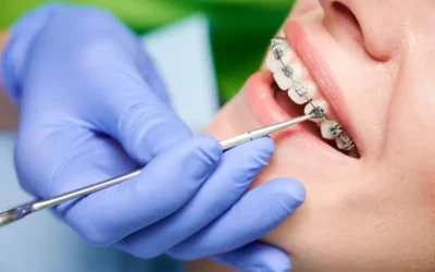 Medicaid Coverage for Orthodontics