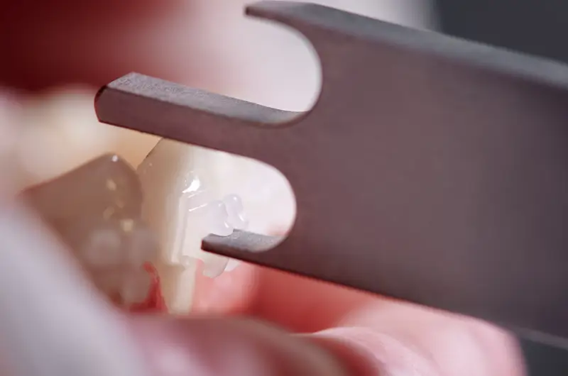 What are the CDT codes to Report Bone Grafts?