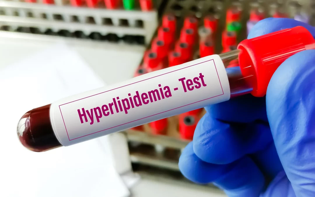 What Are the ICD-10 Codes for Hyperlipidemia?