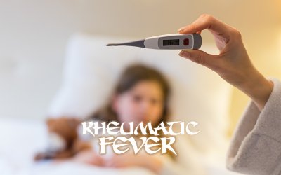 What Is the Correct Code to Report Rheumatic Fever?