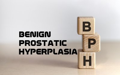 Urology Medical Coding for Benign Prostatic Hyperplasia (BPH)