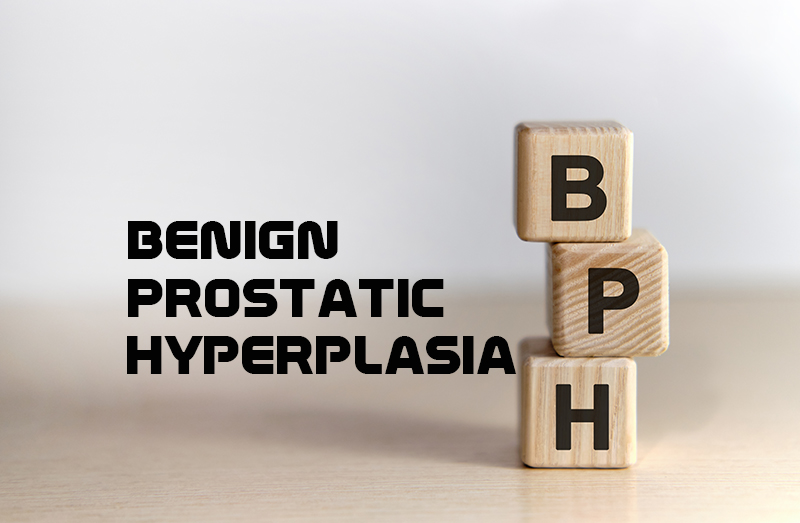 Benign Prostatic Hyperplasia