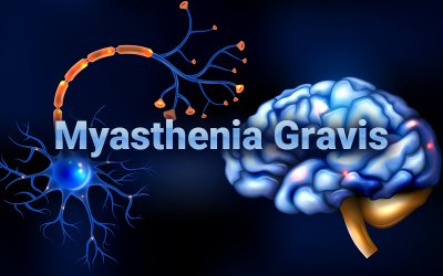 Medical Coding for Myasthenia Gravis – A Common Neuro Muscular Disorder