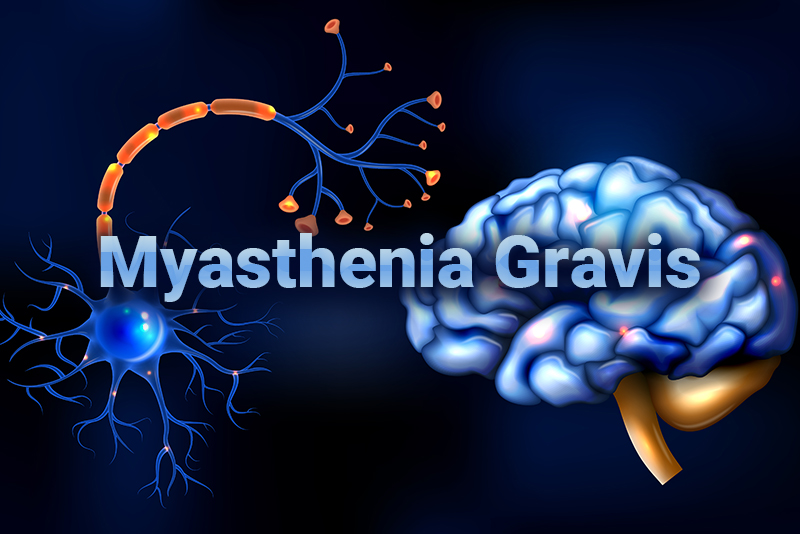 Myasthenia Gravis