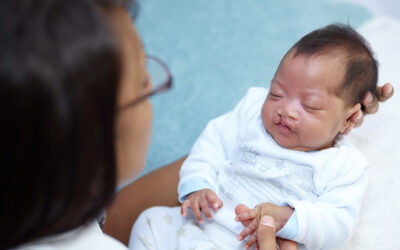 What are the ICD-10 Codes to Report Cleft Lip and Cleft Palate?