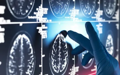 Medical Coding for Top Six Neurological Conditions