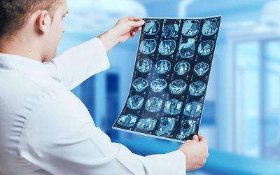Procedures that need Radiology Authorizations and their Codes