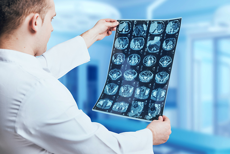 Procedures that need Radiology Authorizations and their Codes