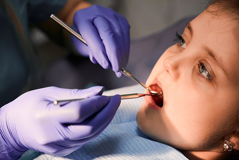 Dental Billing Codes for Gingivectomy