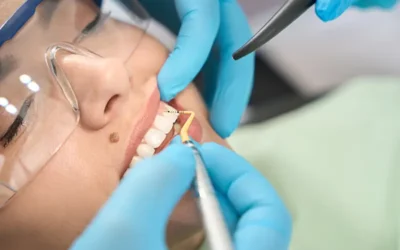 Billing and Coding Periodontal Scaling and Root Planing