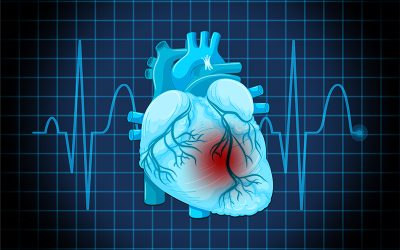 How to Code Cardiomyopathy – A Common Cardiac Condition