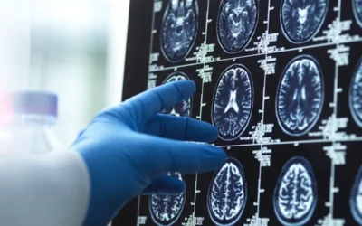 Medical Coding for Encephalitis – Reporting Signs and Symptoms