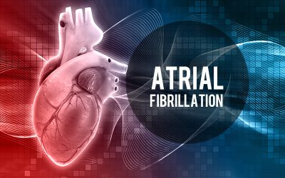 Medical Coding for Atrial Fibrillation – An Irregular Heart Rhythm Disorder