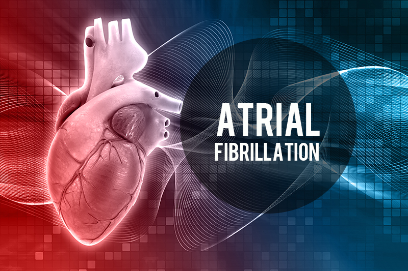 Medical Coding for Atrial Fibrillation