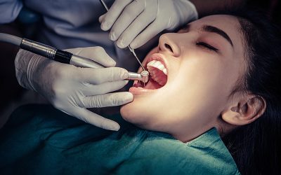 Glossary of Dental Insurance Verification Terms