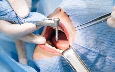 ICD-10 Codes to Report Common Dental Diseases