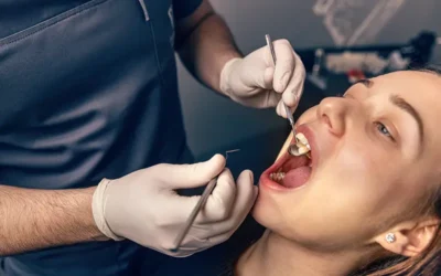 ICD-10 Codes to Report Common Dental Diseases