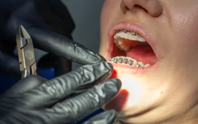 What are the Different Types of Malocclusions and their ICD-10 Codes?