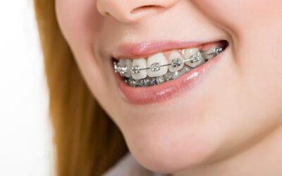 What are the Different Types of Malocclusions and their ICD-10 Codes?