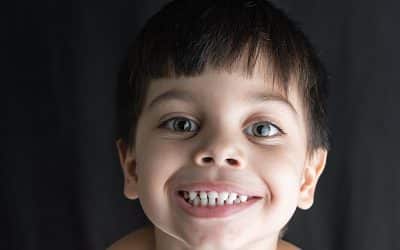 Coding Tooth Developmental Disorders with the Right Codes