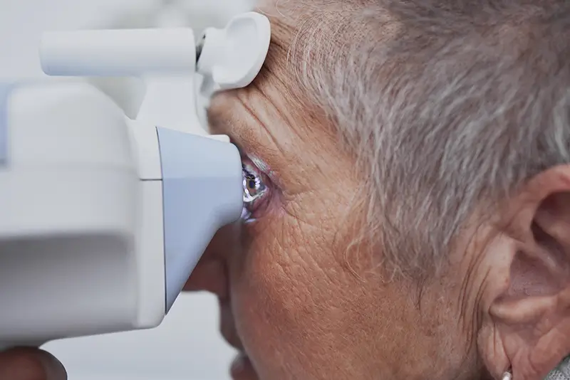 Glaucoma Coding Guidelines