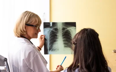 Medical Coding and Documentation Guidelines for Pneumonia