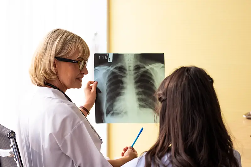 Coding and Documentation Guidelines for Pneumonia