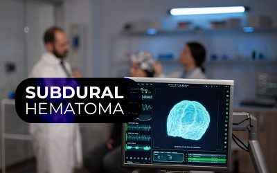 How do you Code and Bill for Subdural Hematoma?