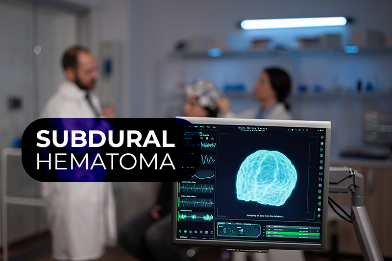 How do you Code and Bill for Subdural Hematoma?