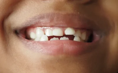 ICD-10 Codes for 11 Rare Tooth Disorders
