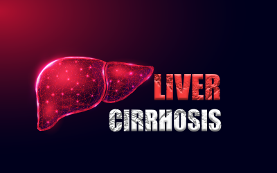 How to Bill and Code for Liver Cirrhosis