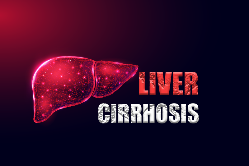 Bill and Code for Liver Cirrhosis