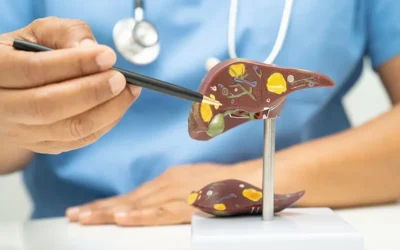 How to Bill and Code for Liver Cirrhosis