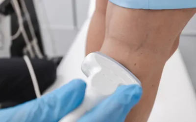 How to Code for Peripheral Artery Disease (PAD)