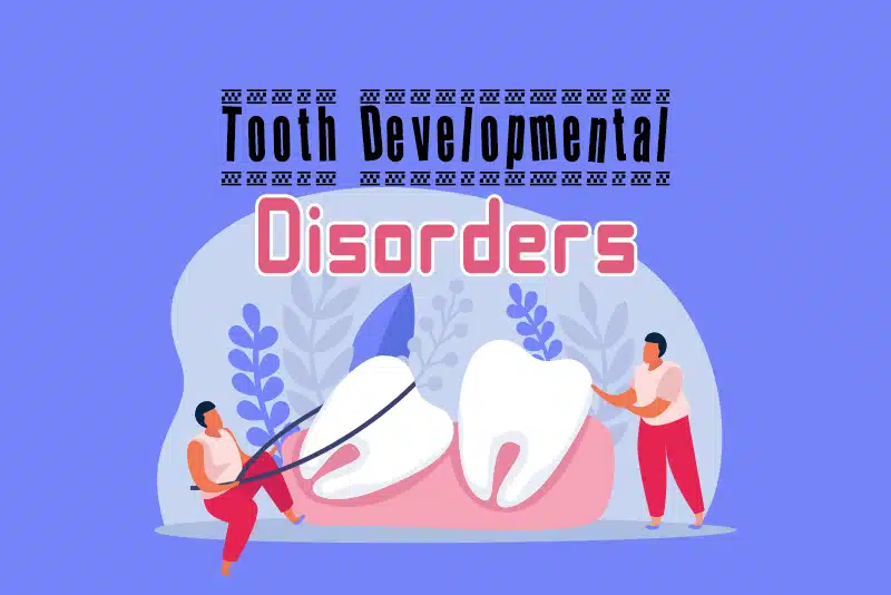 What Are the ICD-10 Codes to Report Tooth Developmental Disorders?