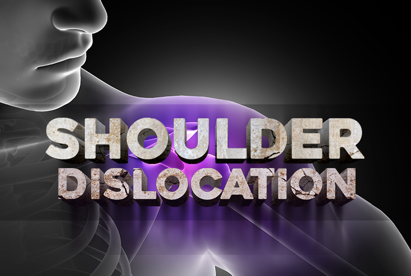 Report Shoulder Dislocation