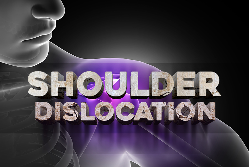 ICD-10 Codes for Shoulder Dislocation