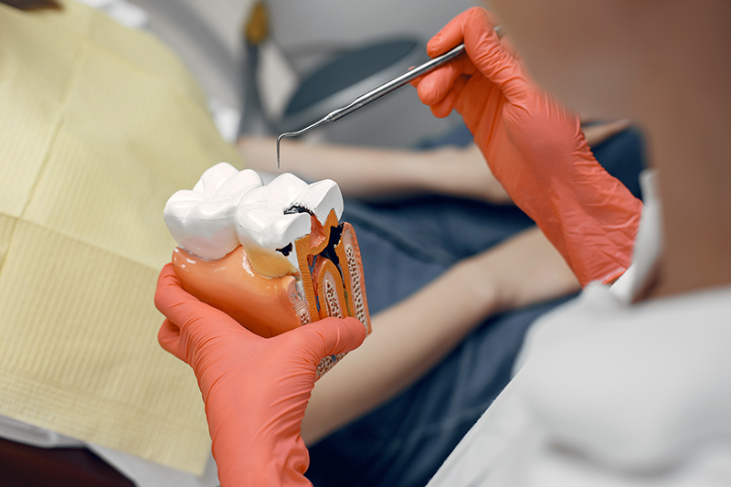 Root Canal Procedures