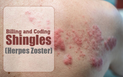 ICD-10 Codes to Report Shingles (Herpes Zoster)