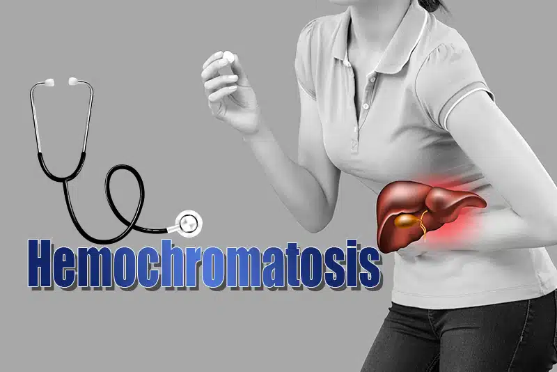 Hemochromatosis Liver Disorder