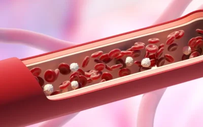 ICD-10 Coding for Peripheral Artery Disease (PAD)