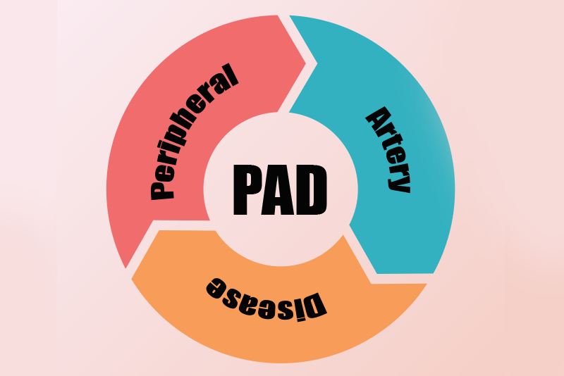 ICD-10 Coding for Peripheral Artery Disease (PAD)