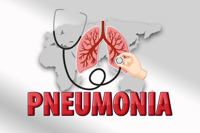 Pneumonia ICD-10 Codes for Accurate Billing