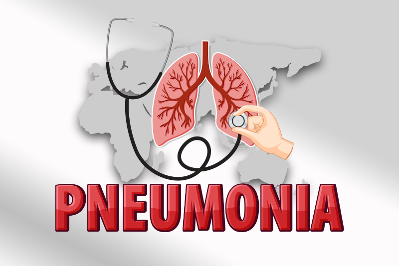 ICD10 Codes to Report Pneumonia