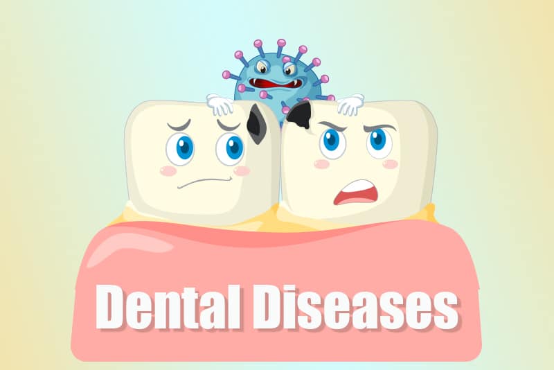 Spring Dental Diseases